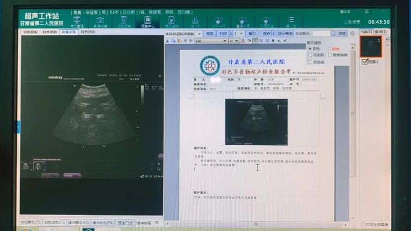 周末也能体检？全身体检中心周末营业解析